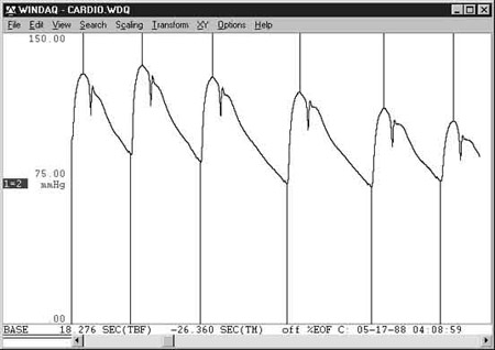 Data Acquisition Waveform - Peak and Valley Capture