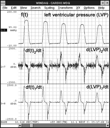 Data Acquisition Waveform - Differentiation Function on ventricular pressure waveform