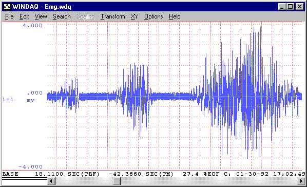 Data Acquisition Waveform - raw EMG signal