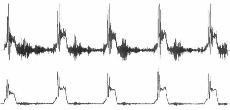Data Acquisition Waveform - 11 point moving average filter applied