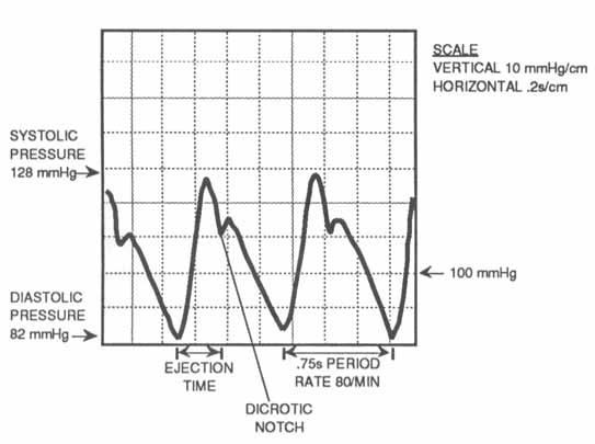 Data Acquisition Waveform - typical arterial blood pressure