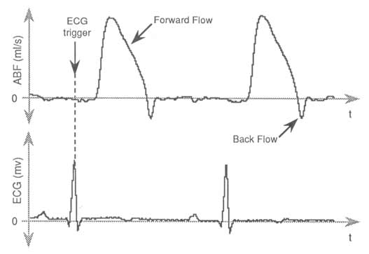 Data Acquisition Waveform - aortic blood flow and ECG signals