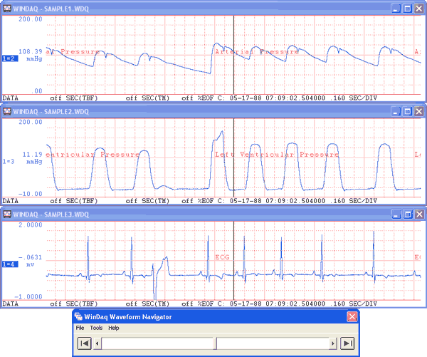 WinDaq data acquisition software.